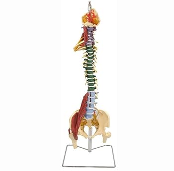 Life Size Spine with Muscles and Disorders