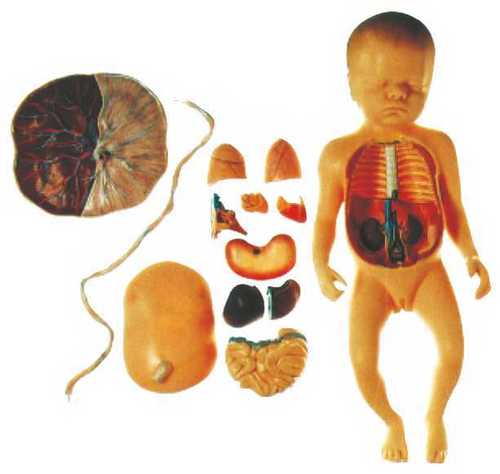 Fetus With Viscus and Placenta