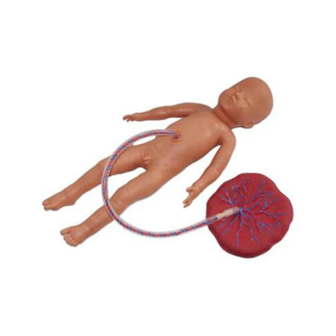 Baby with Placenta and Umbilical Cord