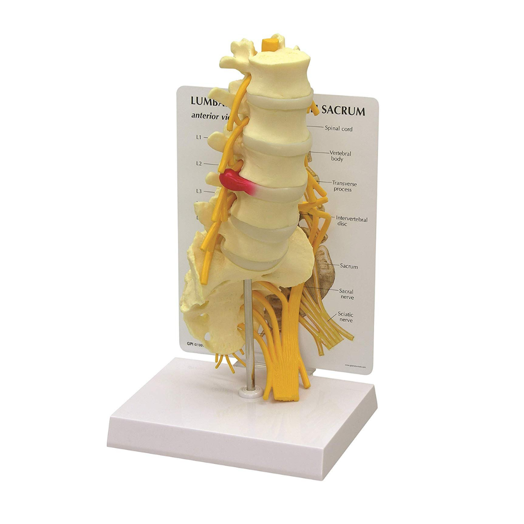 Lumbar Sacrum with Herniated Disc