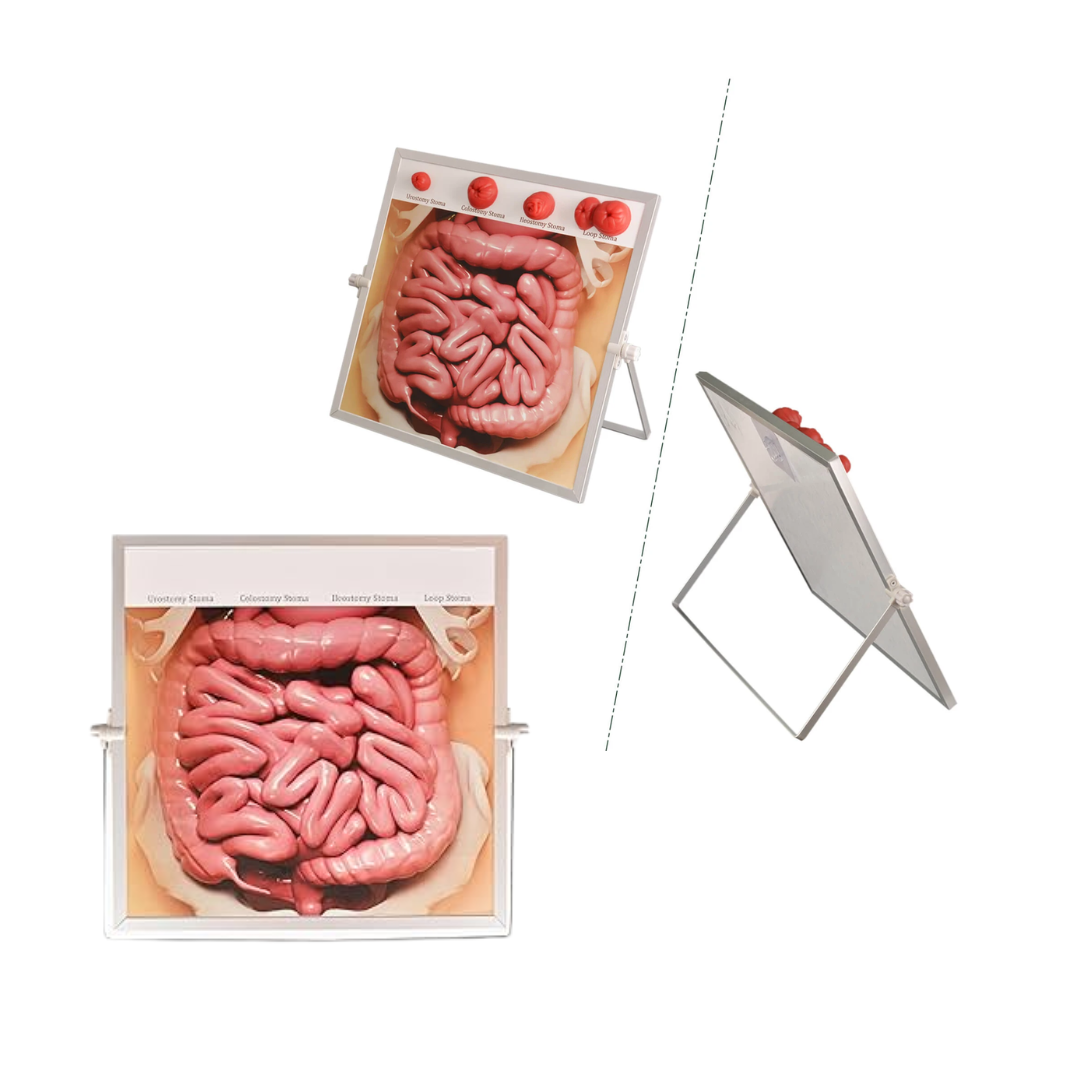 Ostomy Display Board