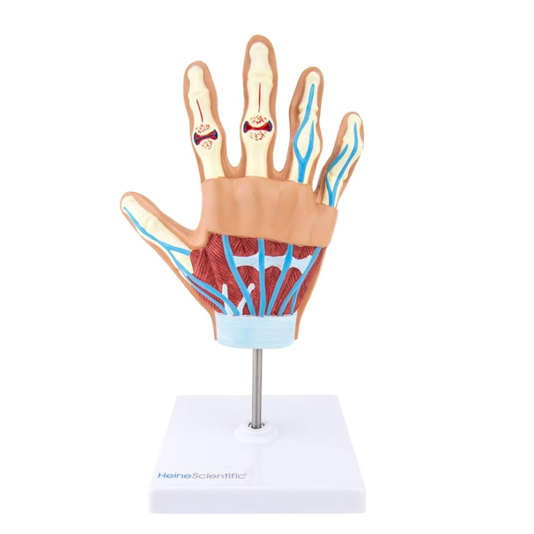 Hand Arthritis Model
