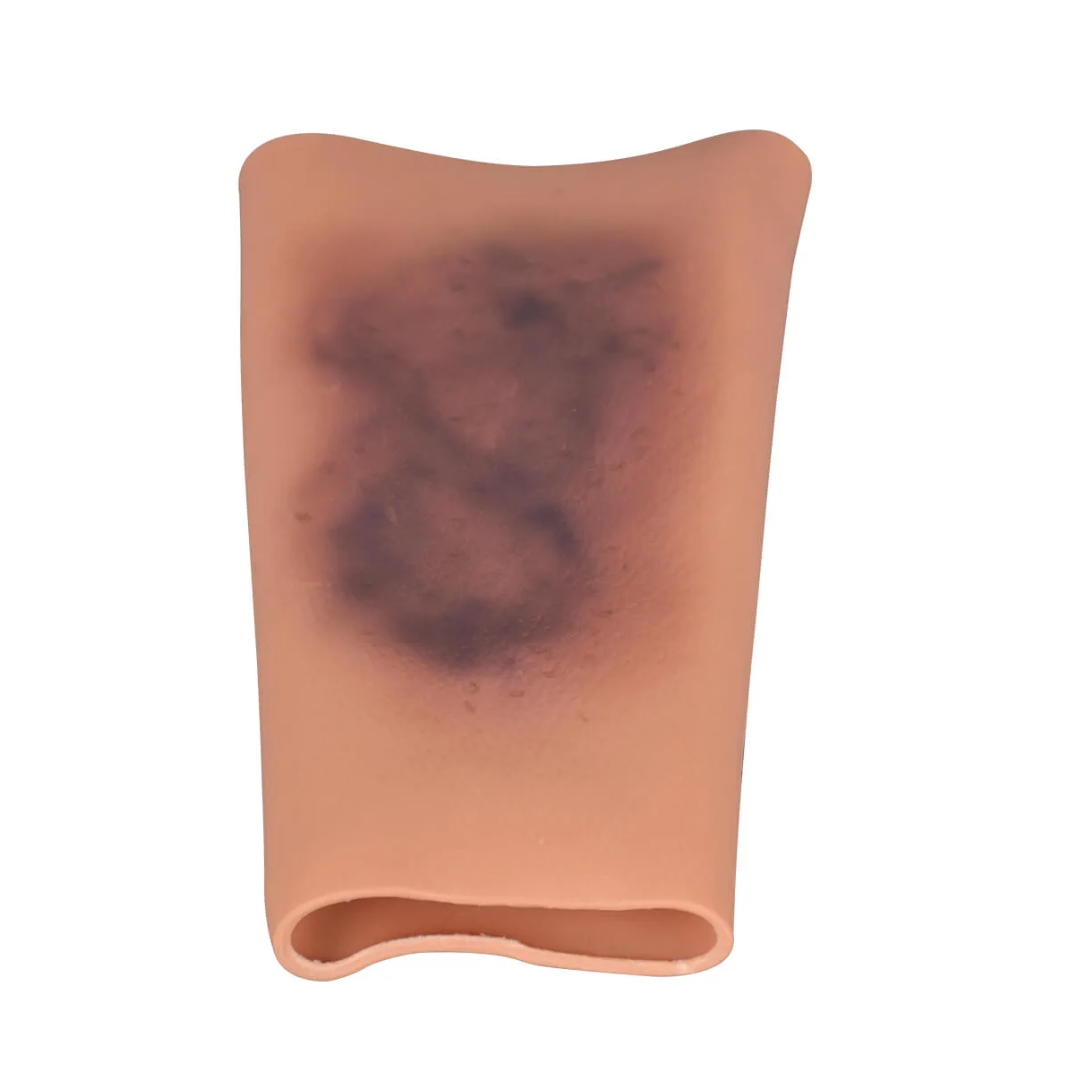 Wearable bruise wound sleeve