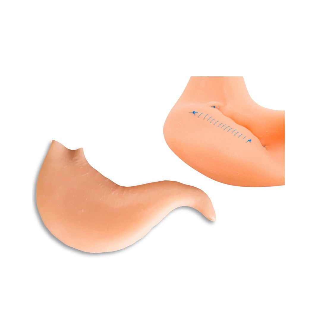 Hollow Organ - Stomach