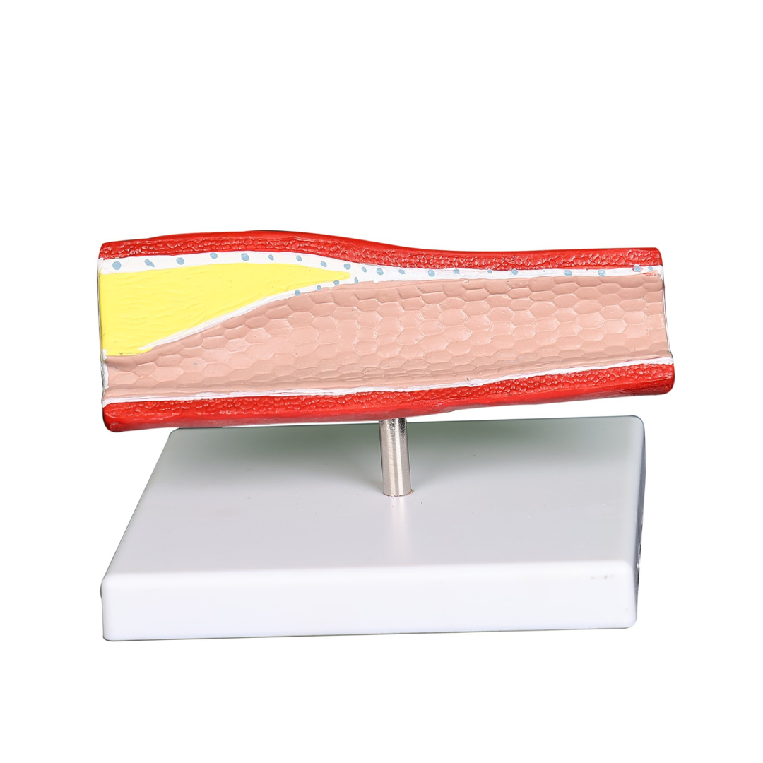 Artery Model