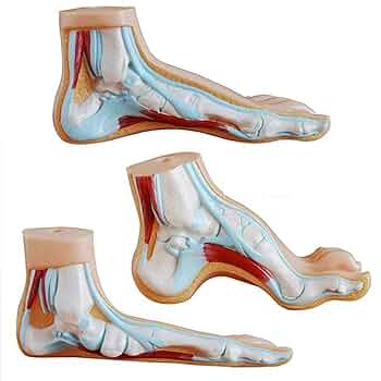 Foot Anatomy Model 3 Parts (Normal, Flat andArched Foot)