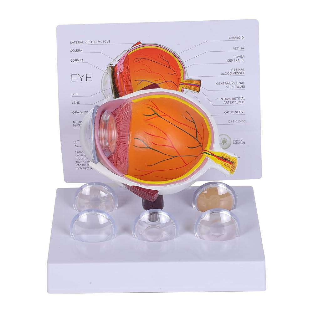 Cataract Eye Model