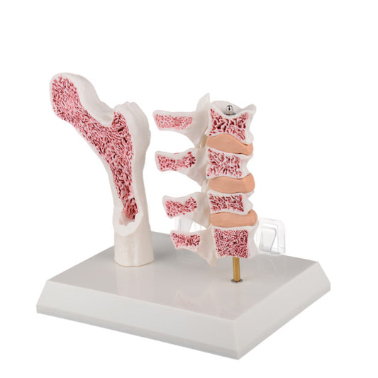 Osteoporosis Model (Femur & 4 Vertebrae)