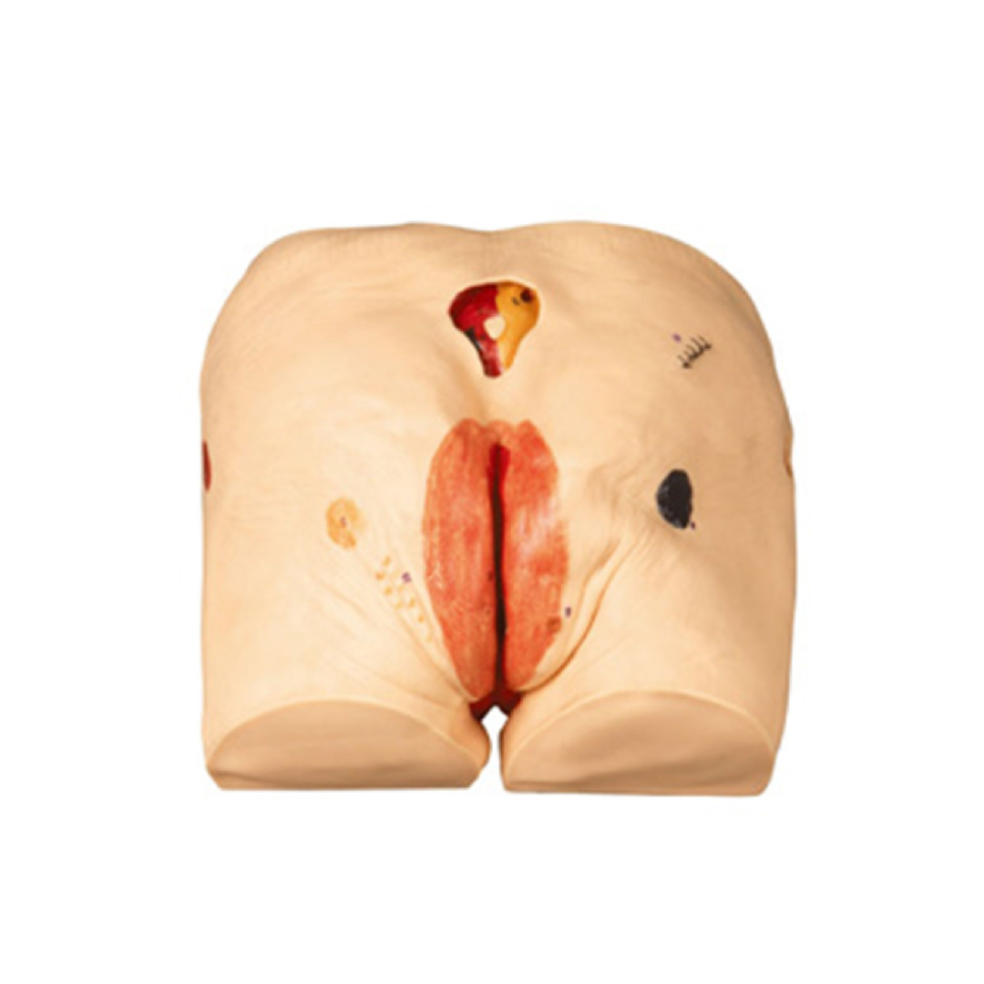 Decubitus Ulcer CareSimulator