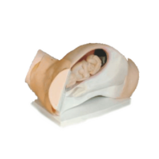 Model For Course of Delivery (Leopold Maneuvers Simulator)