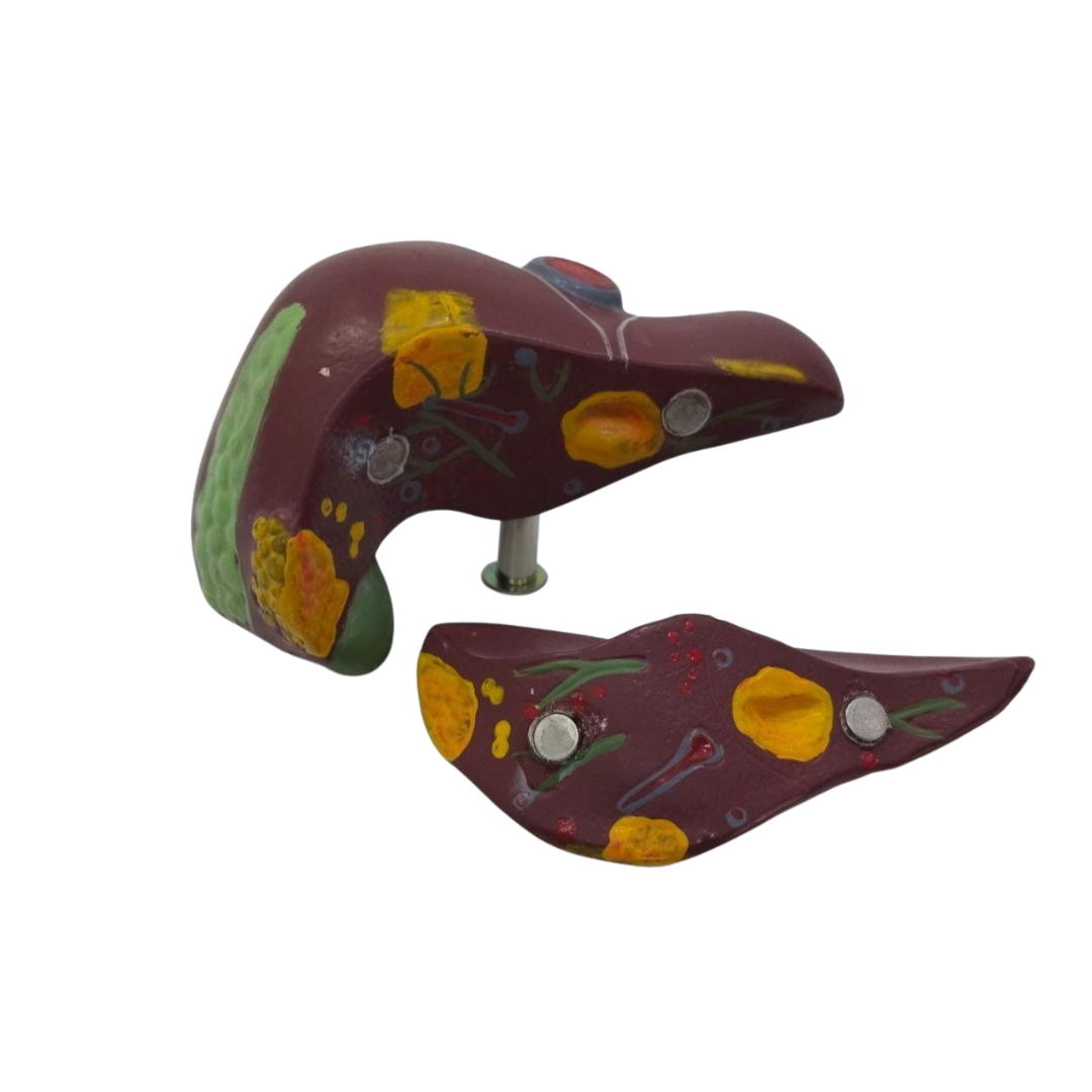 Diseased Liver Model(Small)