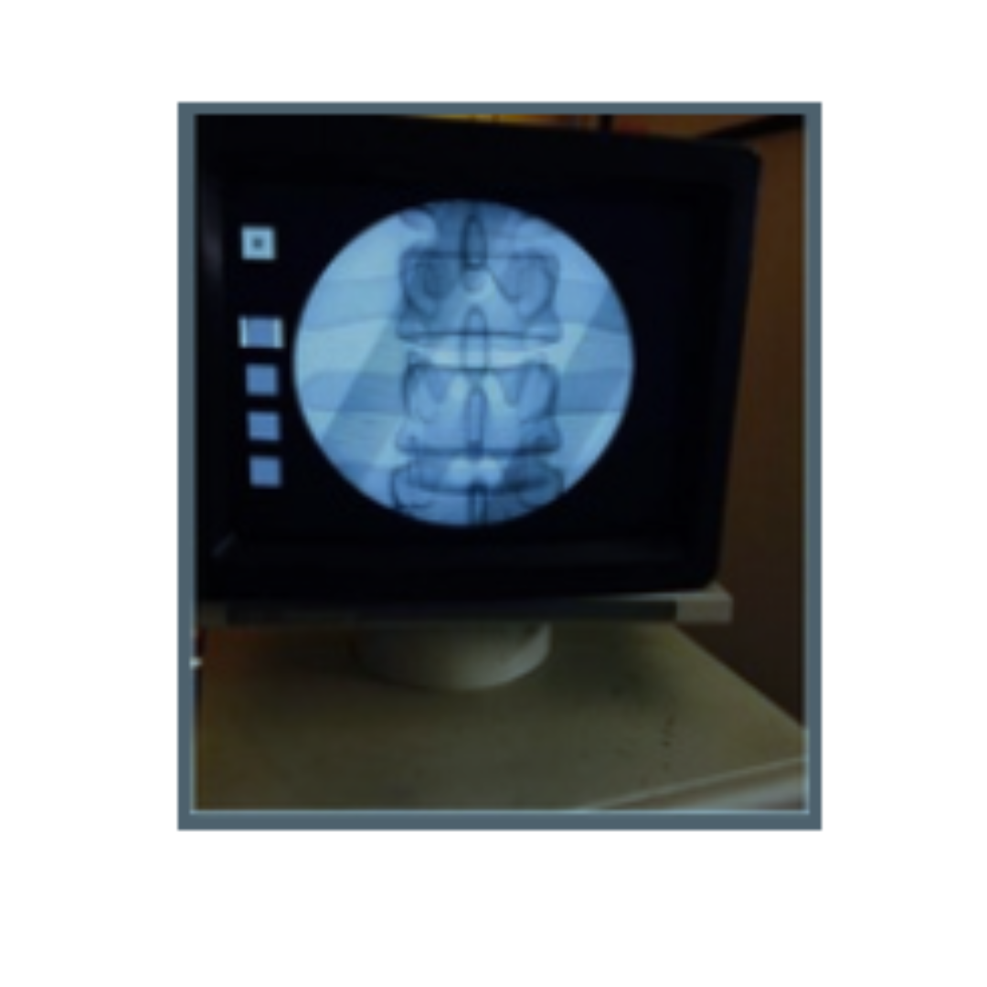Lumbar Fluoroscopy Manikin