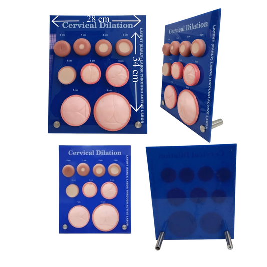 Cervical Dilation Model