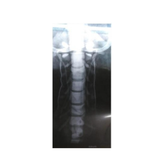 Cervical Fluoroscopy Manikin