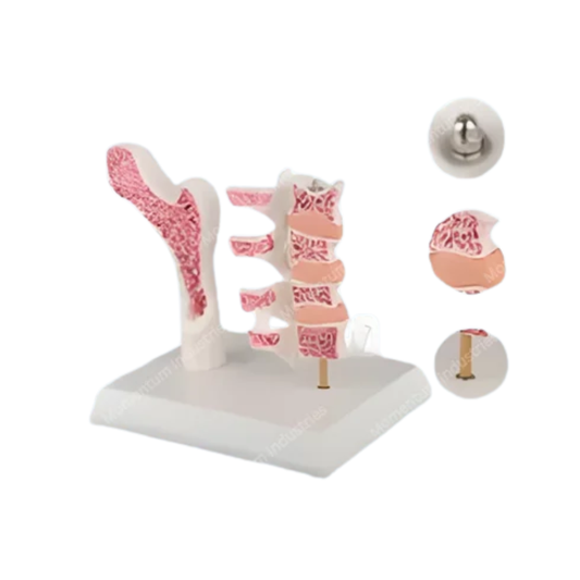 Osteoporosis Model (Femur & 4 Vertebrae)
