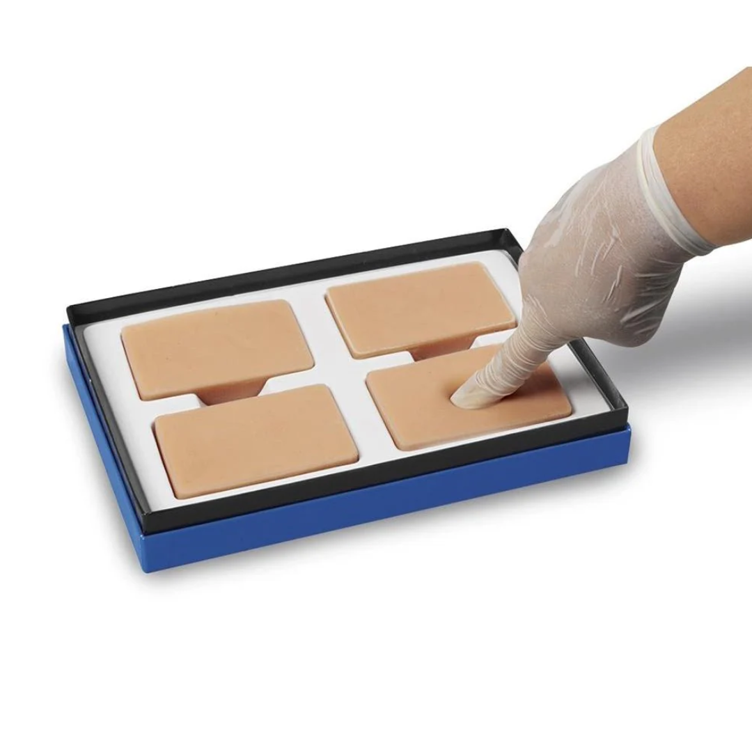 Pitting Edema Training Model