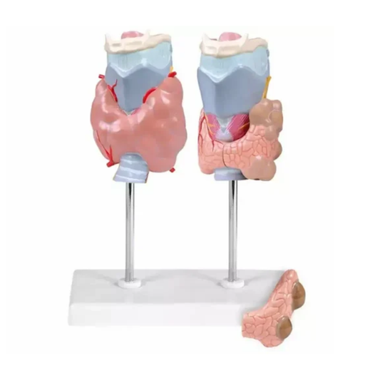 A Thyroid Disease Model