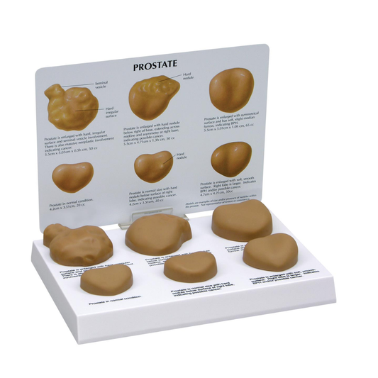Prostate Examination Model