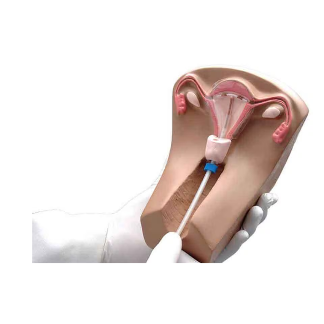 IUD Training Model