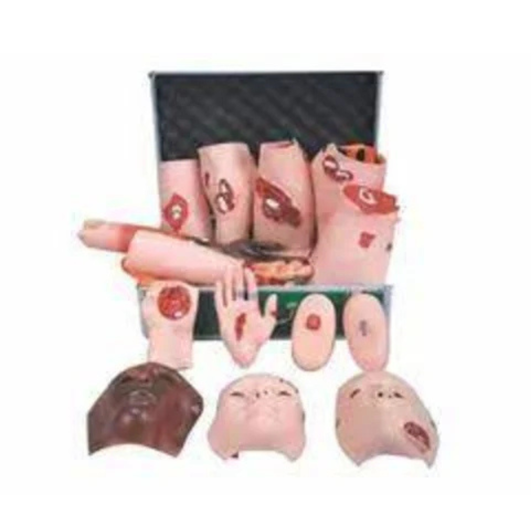 Advanced Trauma Evaluation Model